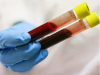 Mời báo giá về việc mua hóa chất phục vụ xét nghiệm đông máu